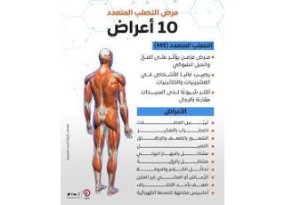 التصلب المتعدد